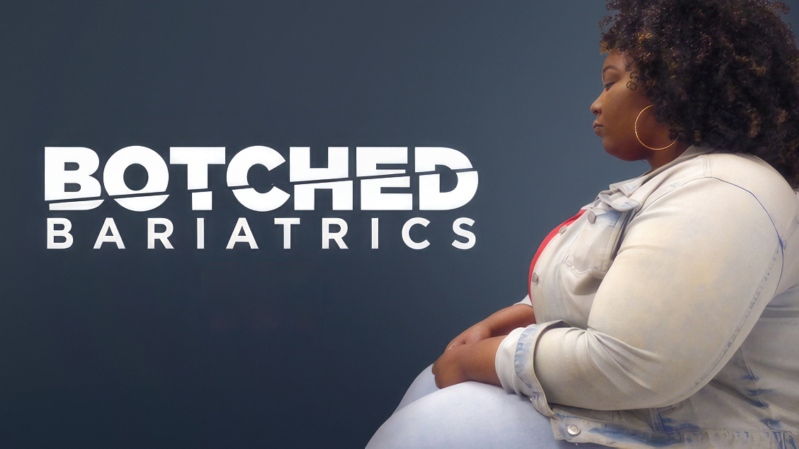 Botched Bariatrics Botched Bariatrics